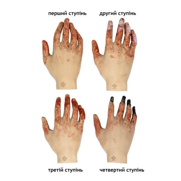 Муляж оморожения IV ступеней, комплект из 4 рук Rescue Ready к.330 фото