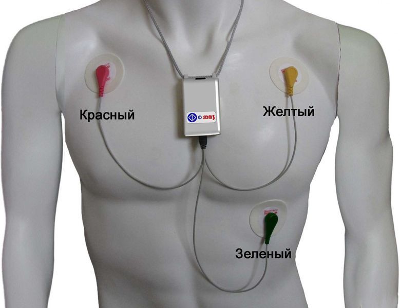 SDM3 (Холтер ЕКГ) BM0095 фото